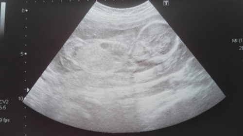 05fe93d583dad165med.jpg